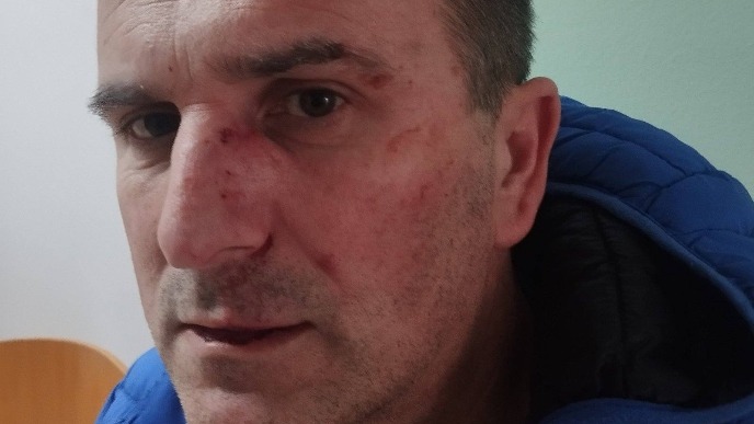 Pretučen aktivista SDS